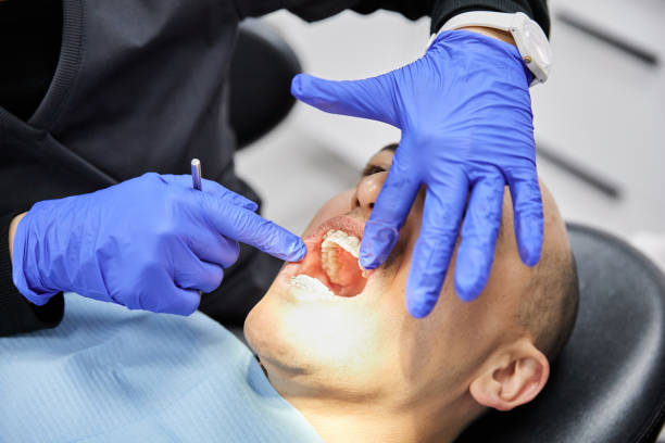 Best Emergency Treatment for Dental Infections or Abscesses in Colfax, CA